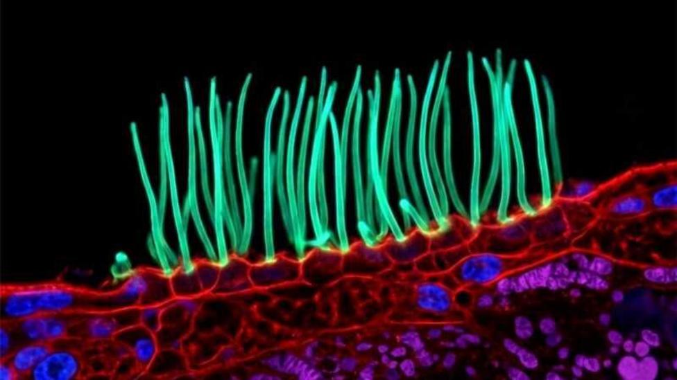 Nikon Photo Contest Faces Backlash Over Tiny Image Entry